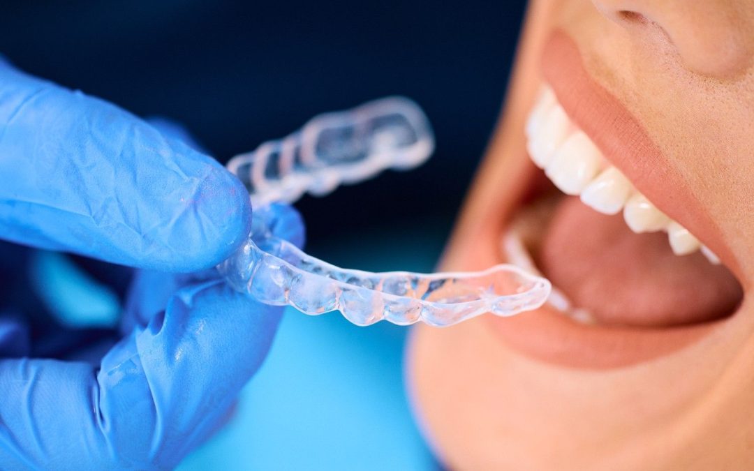 Invisalign vs Braces : Costs, Advantages, and Disadvantages